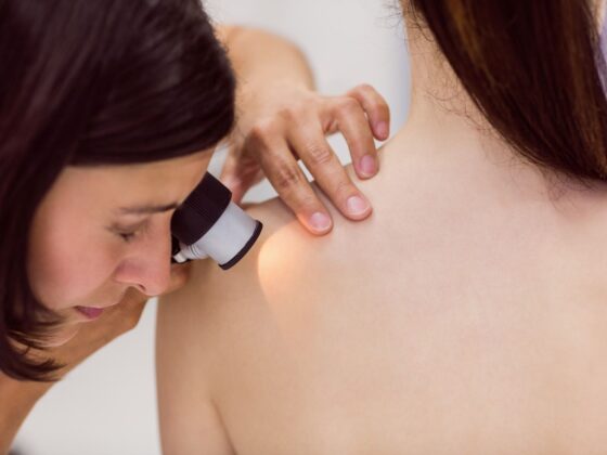 Dermatoscopie