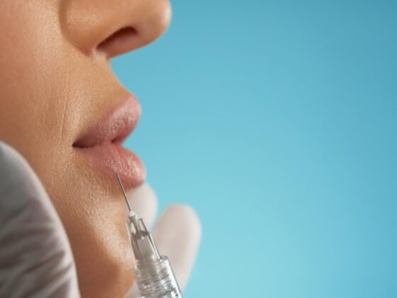 Lifting facial non-chirurgical Tratament cu Botox sau Filler