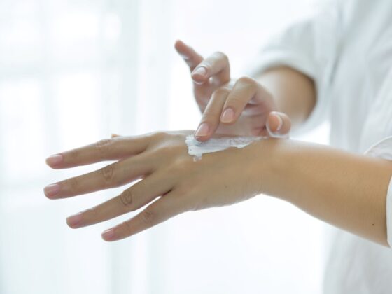Dermatita atopica afectiune cronica frecventa recurenta