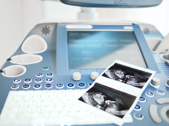 Ecografia prenatală completă Liniște și sănătate pentru bebeluș