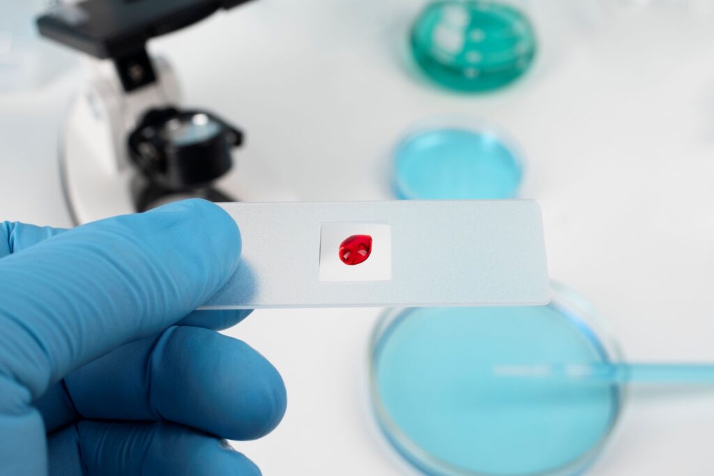 Anemia: teste de laborator folosite pentru analizele de sânge.