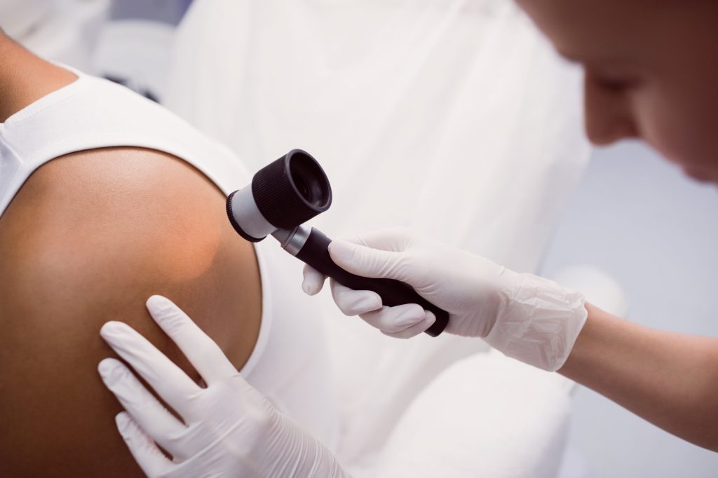 Dermatoscopia permite monitorizarea precisă a alunițelor și depistarea timpurie a riscurilor de melanom.