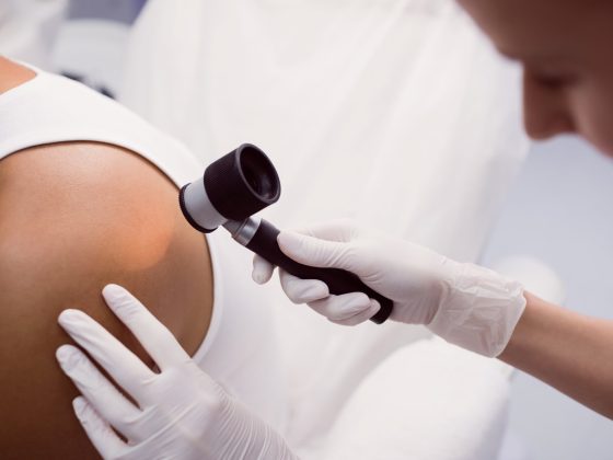 Dermatoscopia permite monitorizarea precisă a alunițelor și depistarea timpurie a riscurilor de melanom.