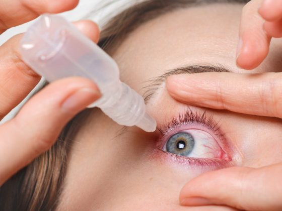 Picături pentru sindromul de ochi uscați aplicate pentru ameliorarea disconfortului ocular. Tratament cu lacrimi artificiale